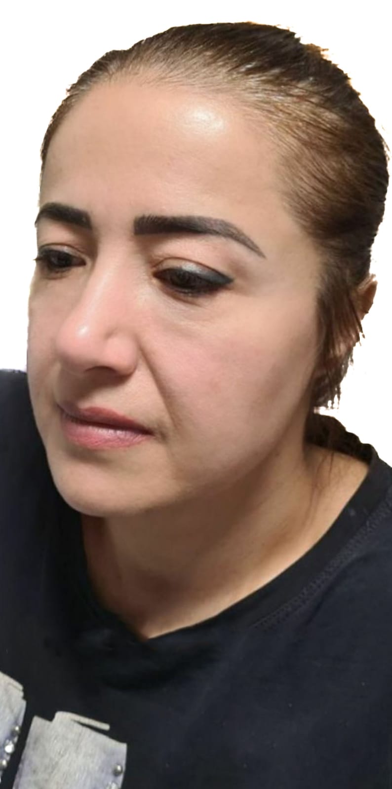 פיסול פנים לפני